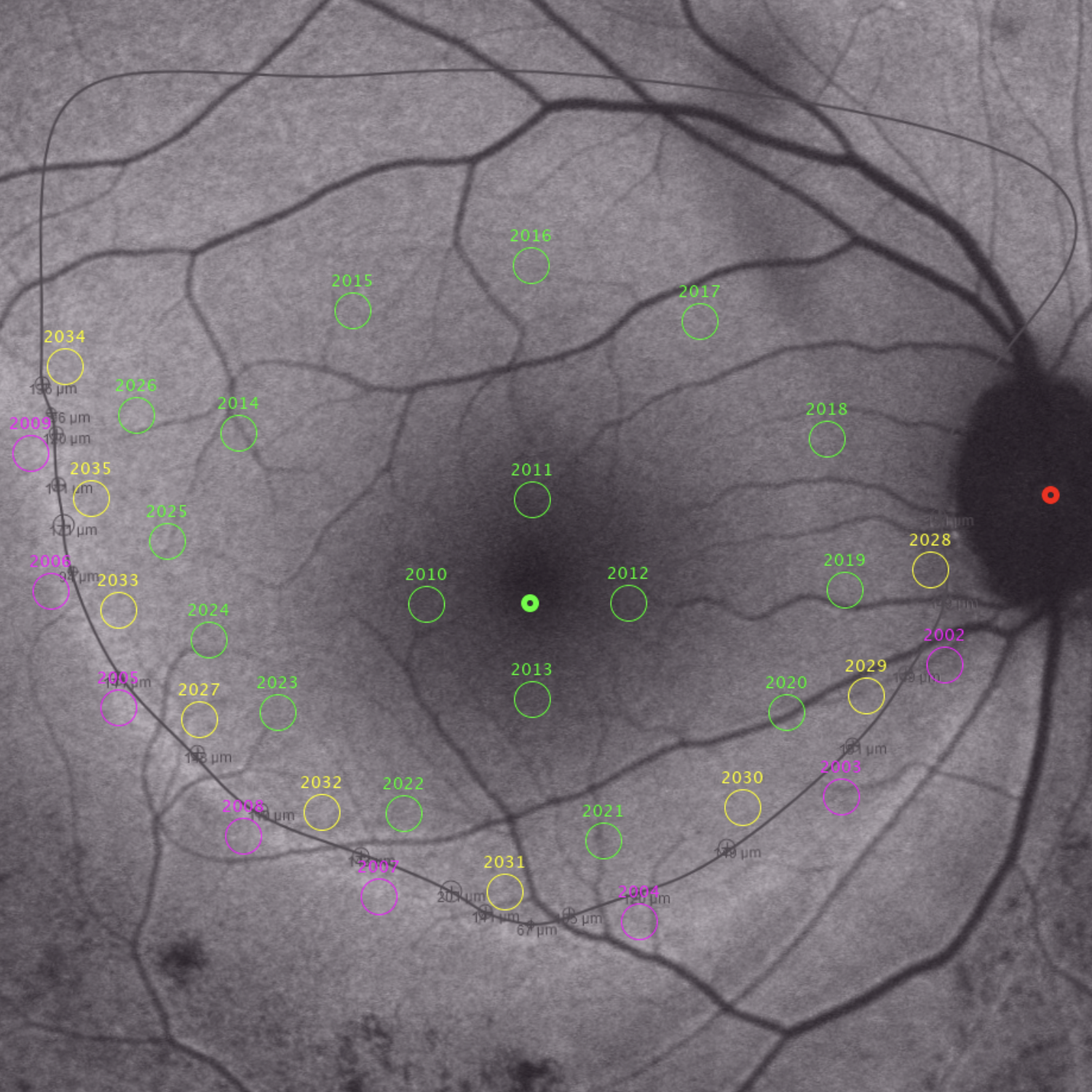 Proprietary Algorithms (IGMP + StarGauge)