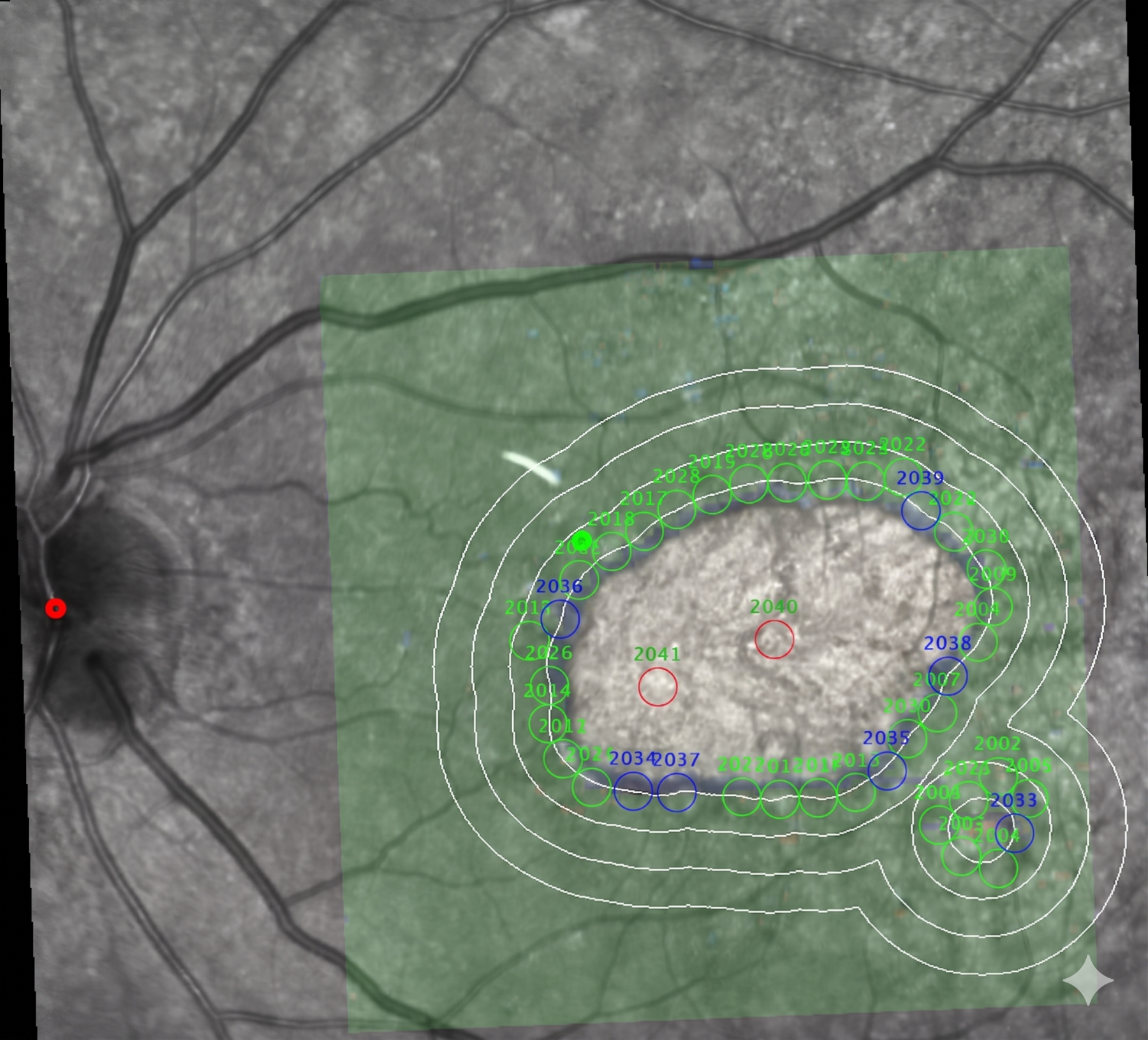Image Analysis & Endpoints