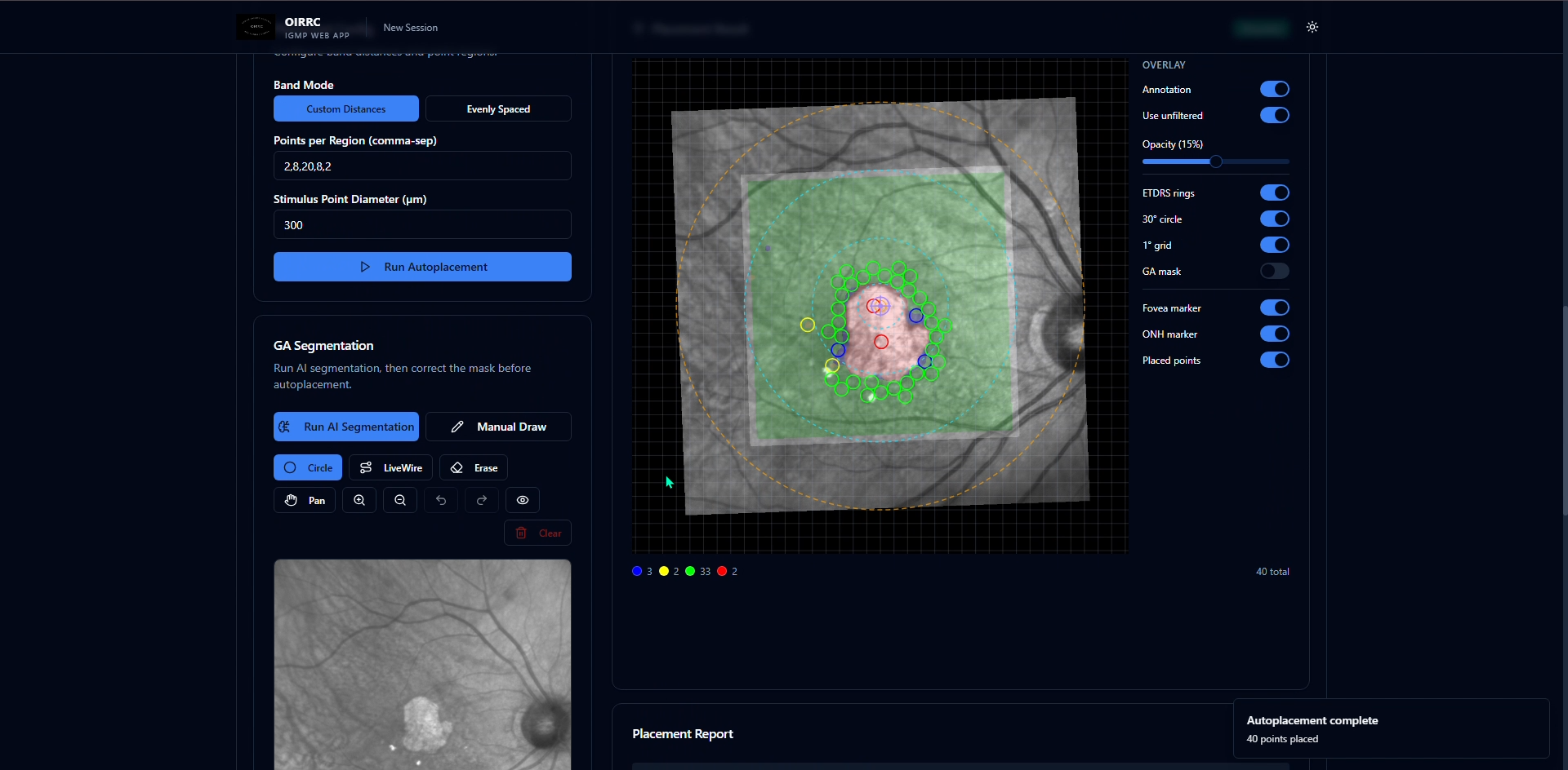 Proprietary Algorithms (IGMP + StarGauge)