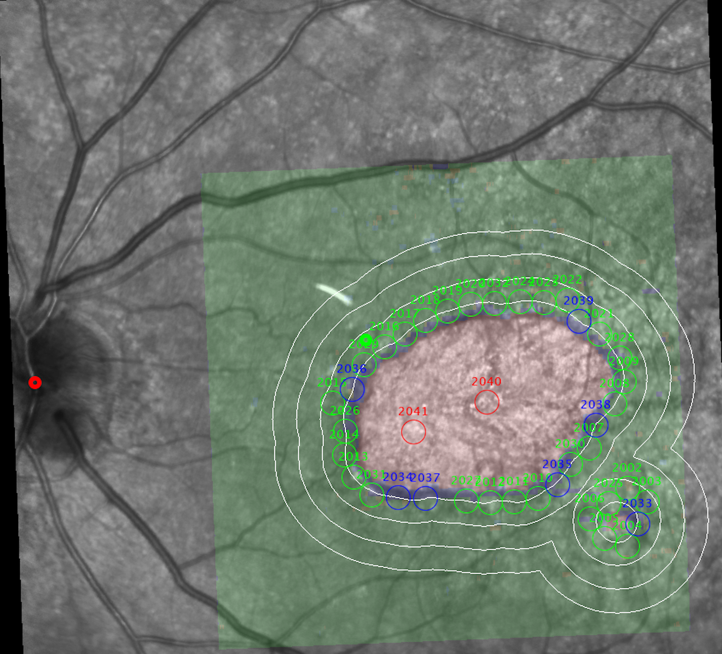 Proprietary Algorithms (IGMP + StarGauge)